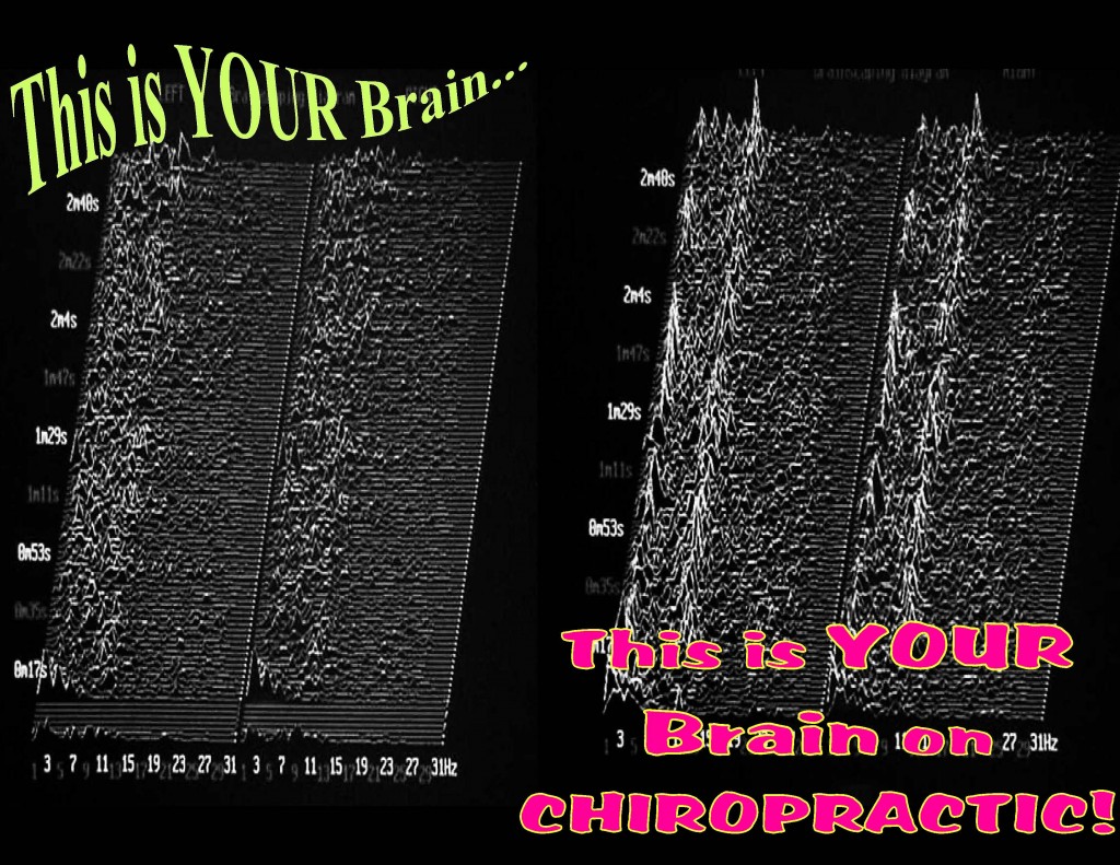 Brain on Chiropractic